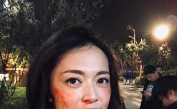 姚晨晒“被打残”自拍，网友：明玉，打回去！