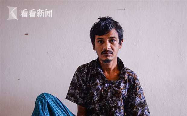 慎入!25 次手术切完又长,男子双手如枯树枝苦求截肢