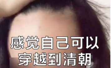女人秃起来 比男人厉害多了! 女人秃起来 比男人厉害多了!