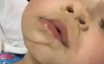 月嫂把婴儿当狼砍杀！3 名婴儿 2 名大人被刺伤，受害者索赔 7000 多万