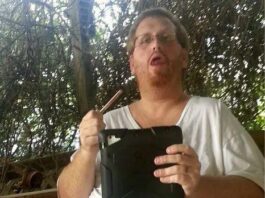 不运动就瘦掉 300 斤？他经历了两场手术，被缝了 2400 多针！