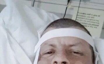 27 年没去看过牙医,再去时竟要被切掉 90% 下颌? 27 年没去看过牙医,再去时竟要被切掉 90% 下颌?