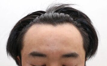 整容实锤、三个女友?这次看他怎么洗 整容实锤、三个女友?这次看他怎么洗